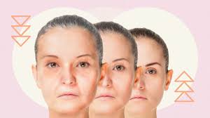 age